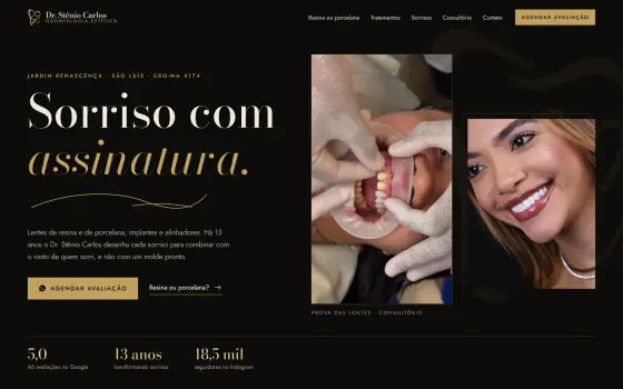 Site Dr. Stênio Carlos, lentes de contato dental